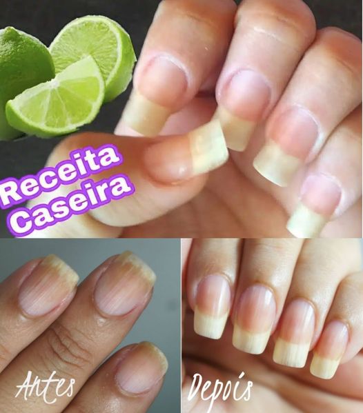 Dica Caseira Para Ter Unhas Grandes E Resistentes Receitas Artesanais